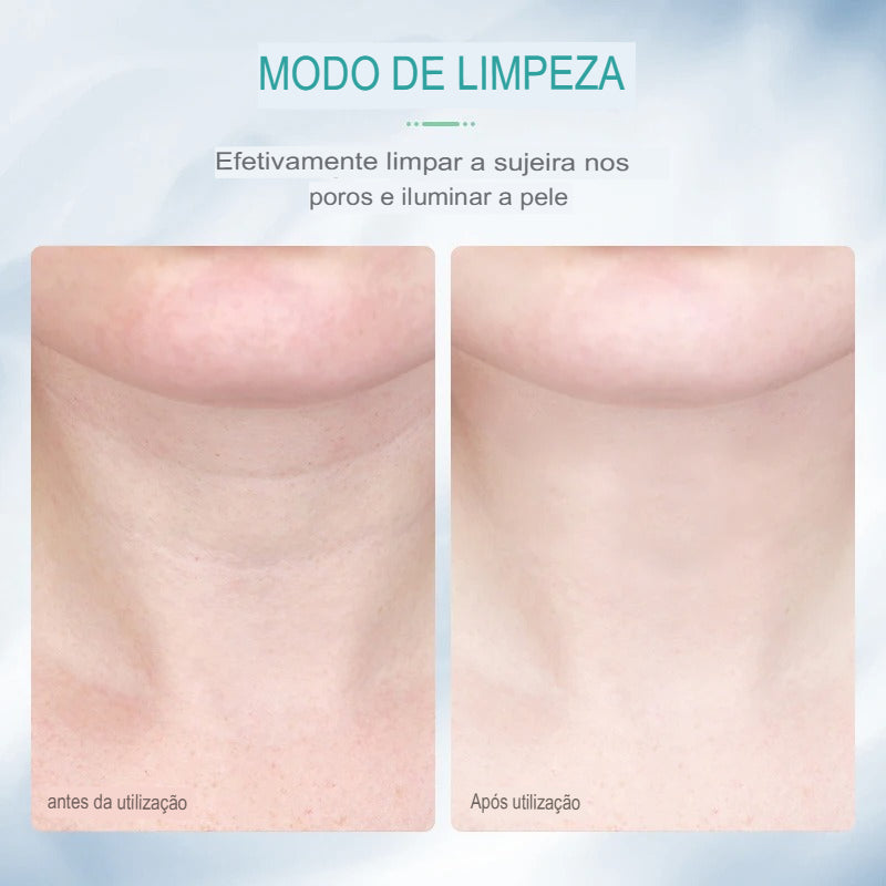 Massageador para Pescoço e Rosto - LiftBeauty -Lifting Facial