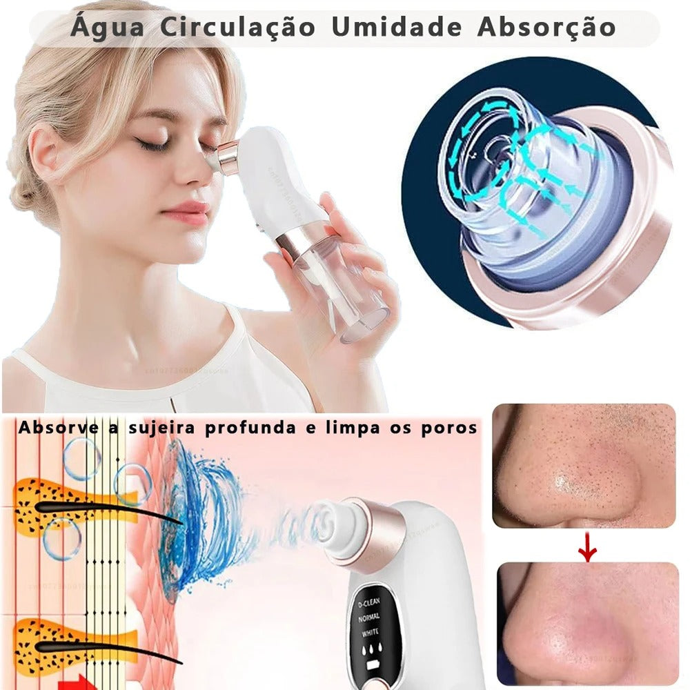 Removedor de Cravos HydraLimp - Rejuvenescimento da Pele, Remoção de Pele Morta