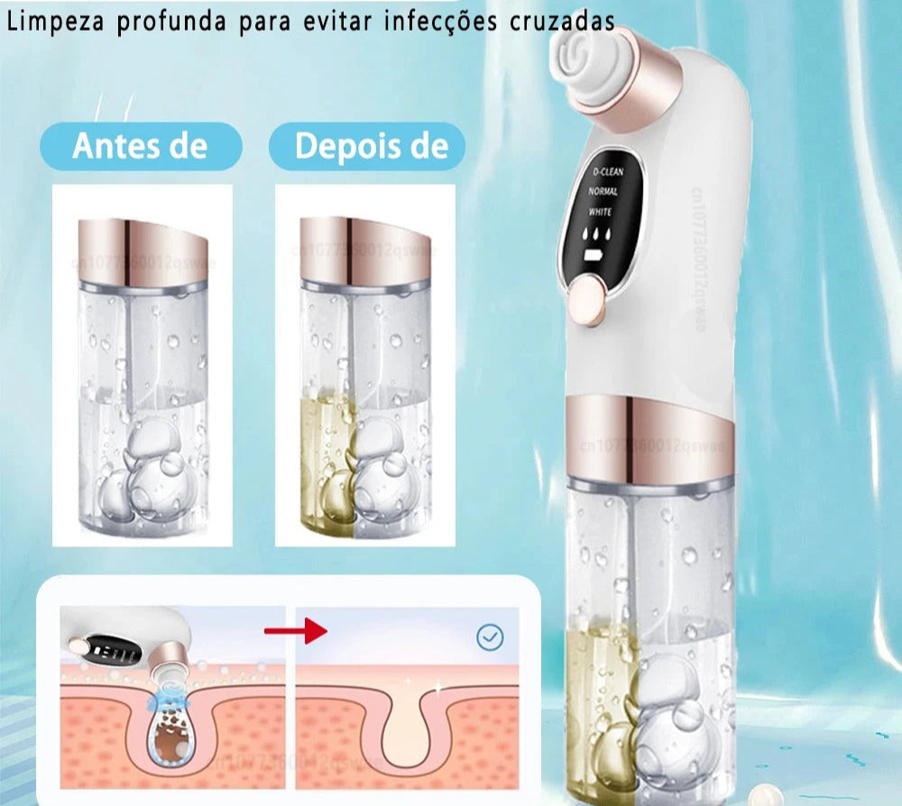 Removedor de Cravos HydraLimp - Rejuvenescimento da Pele, Remoção de Pele Morta